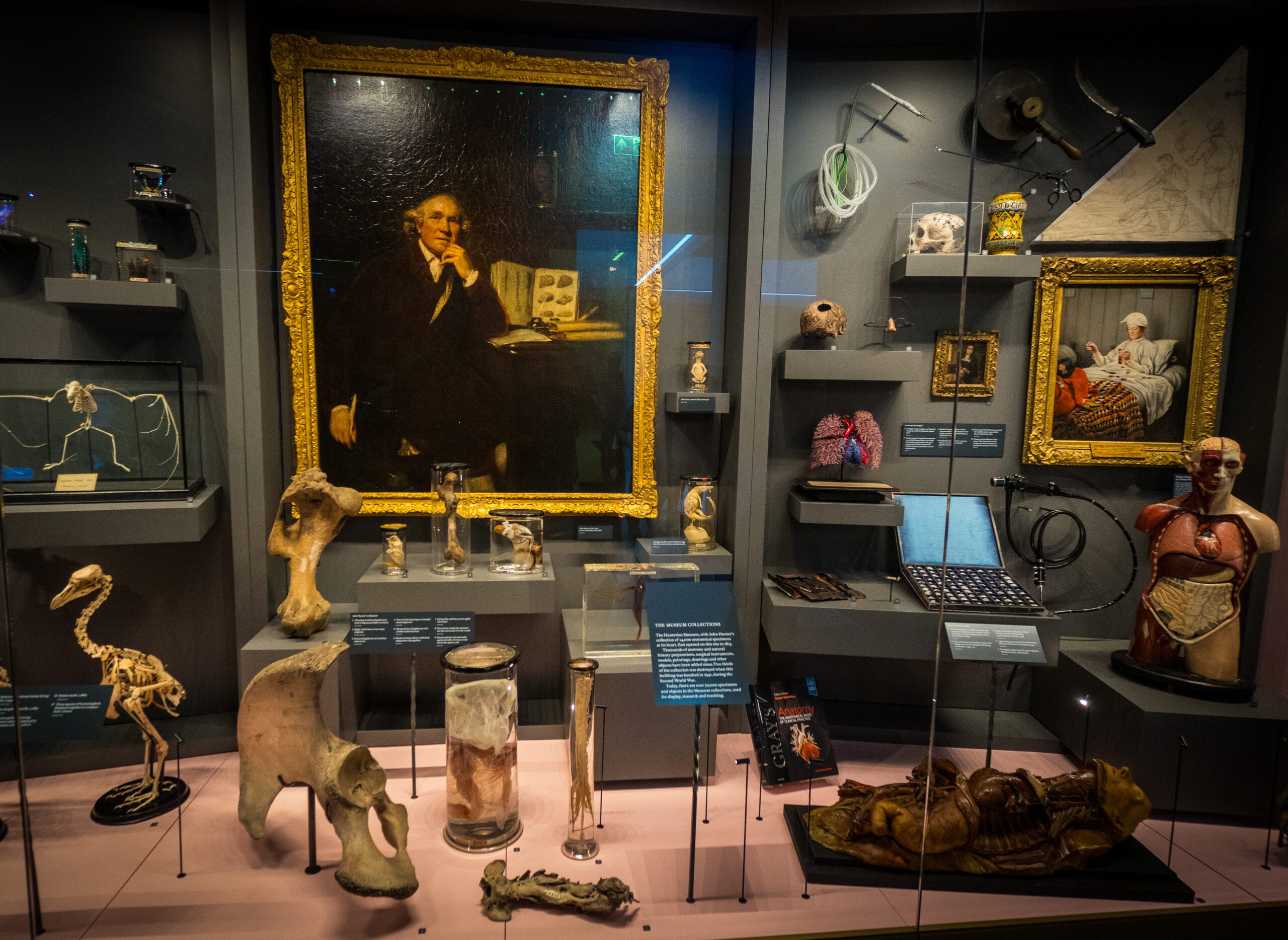 Hunterian Museum: All you need to know